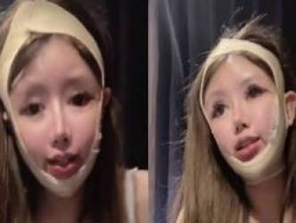 Phát cuồng định nghĩa ‘ngoại hình đạt chuẩn’, con gái Trung Quốc phẫu thuật thẩm mỹ từ sớm, coi dao kéo chỉ như món đồ xa xỉ bạc triệu